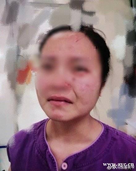 外籍确诊男子不配合隔离还咬伤护士，广州警方刑事立案