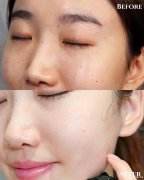 渗透式补水夏日不脱妆，名膜壹号黑金面膜每天用吗？