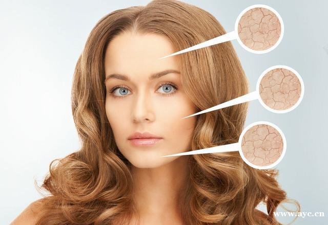 皮肤干燥怎么办?除了补水自然兰还建议补油 皮肤干燥怎么办?除了补水自然兰还建议补油