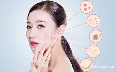 秋天干燥用什么护肤品好？名膜壹号产品怎么样