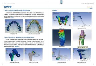 abaqus工程结构医学骨科有限元分析培训 abaqus工程结构医学骨科有限元分析培训