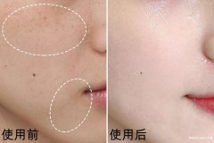 不黑不吹，亲身体验的自然兰童颜面膜评测来了