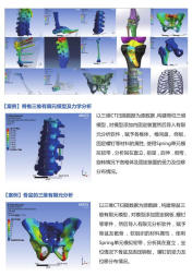 ansys结构优化骨科力学有限元分析培训 ansys结构优化骨科力学有限元分析培训