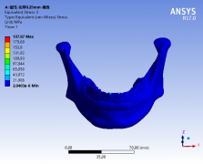 ansys结构力学生物力学骨科口腔分析培训