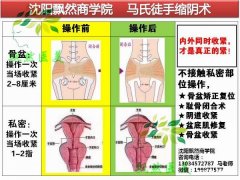 一指私密骨盆闭合专业培训机构 沈阳飘然商学院