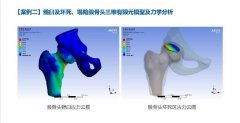 生物力学分析医学骨科口腔分析培训包教会