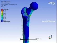 Ansys生物力学有限元分析培训