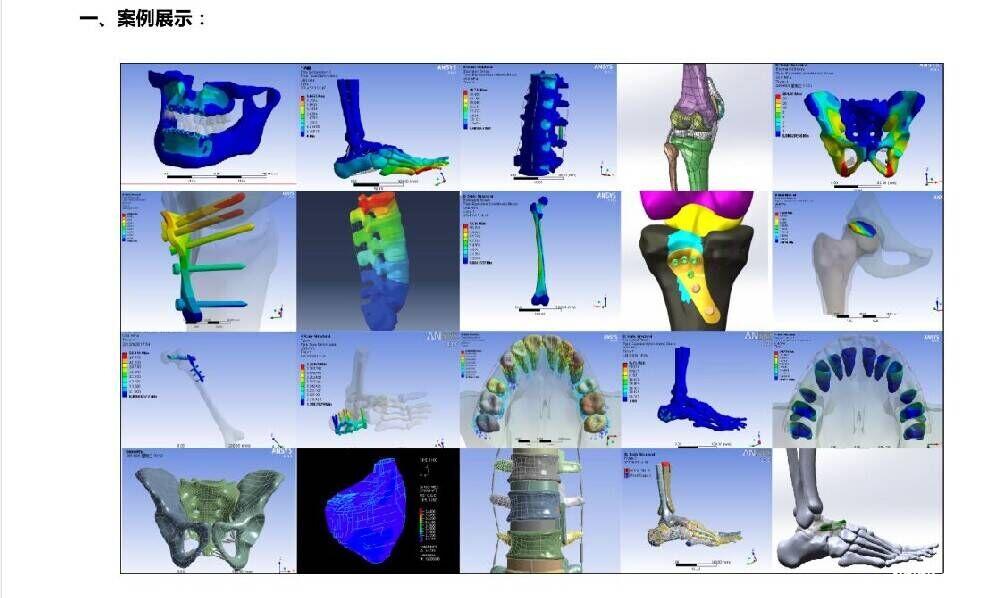 数字医学骨科口腔有限元分析培训一对一教学包教会 数字医学骨科口腔有限元分析培训一对一教学包教会