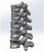 数字医学有限元分析培训包会