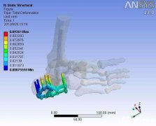 深圳数字医学生物力学有限元分析培训