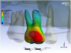 生物力学骨科口腔有限元分析培训