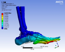 广州Mimics培训骨科有限元分析培训