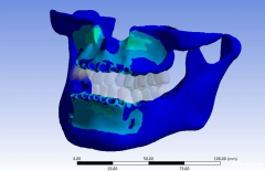 广州Mimics培训骨科有限元分析培训