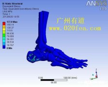 生物力学ct提取建模有限元分析培训一对一教学包会