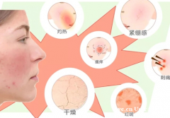 郑明明护肤品敏感肌可以用吗？看完一定要收藏