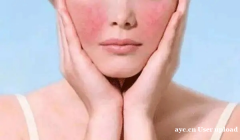 郑明明干货推荐丨敏感肌肤用什么护肤品比较好？