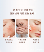 敏感肌该怎么护肤？一定要试试郑明明贻贝修护赋活套组