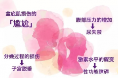 盆底肌修复，您想知道的干货都在这里！