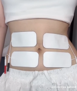 产后妈妈的“腹愁者联盟”：腹直肌分离的烦恼与修复大作战