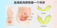 认识盆底肌——女性健康的“隐形守护者”