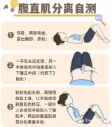 腹直肌修复的重要性与方法 腹直肌修复的重要性与方法