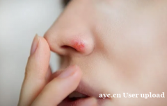 春季过敏性鼻炎高发？伟而特紫外空气消毒机为你保驾护航