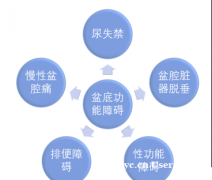 练好盆底肌有哪些好处​​