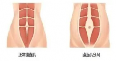 ​​科普 | 原来不是胖，而是它“裂开了”