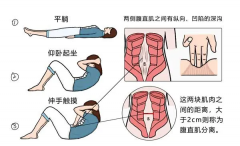 产后妈妈必看！腹直肌修复 + 瘦肚子避坑指南，后悔没早点知道