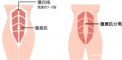 天啊！超过2指还做仰卧起坐？90%的宝妈正在毁掉自己的腰！