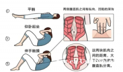 科学修复腹直肌分离，产后妈妈也能重拾平坦小腹！​​