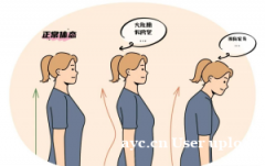 产后妈妈逃不过的体态问题，你中了几个