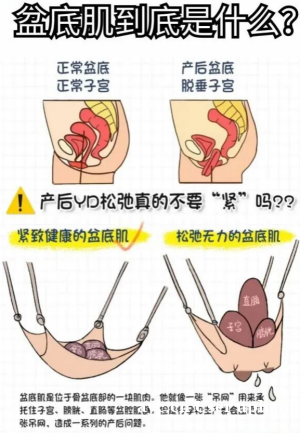 产后修复不是选择题:给每个妈妈的健康重启键 产后修复不是选择题:给每个妈妈的健康重启键