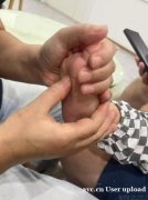 手护到家小儿推拿 家长心中的“绿色健康守护者”