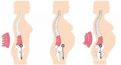 产后康复黄金期：盆底肌+腹直肌修复全攻略