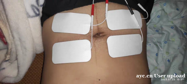 产后肚子松垮瘦不下?别急着跳操,先修复腹直肌这个“地基”! 产后肚子松垮瘦不下?别急着跳操,先修复腹直肌这个“地基”!