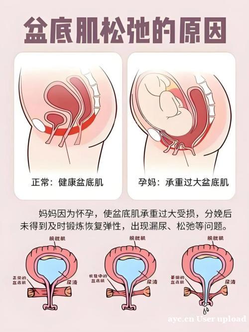 产后通关新难题:激素波动下,如何守护盆底肌力? 产后通关新难题:激素波动下,如何守护盆底肌力?