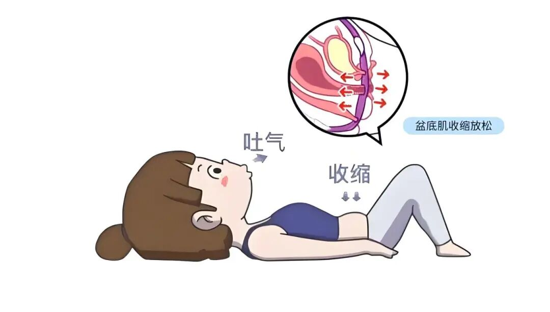 尿失禁困扰多?一种呼吸法悄悄修复盆底肌,许多人没重视 尿失禁困扰多?一种呼吸法悄悄修复盆底肌,许多人没重视