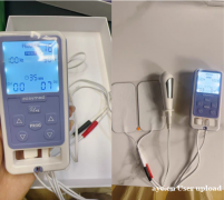 产后修复仪器实测｜易舒美盆底肌修复仪：在家做康复，真的能省心