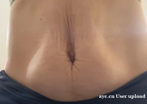 超过60%产后女性都在为这件事烦恼!腹直肌分离修复试试这个办 超过60%产后女性都在为这件事烦恼!腹直肌分离修复试试这个办