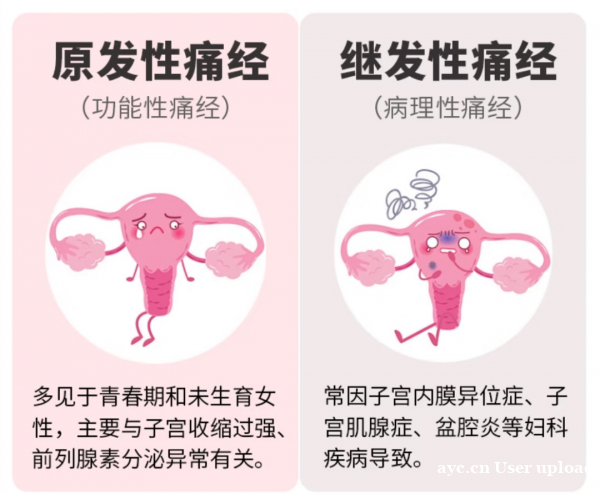 我国超60%女性受痛经困扰!除了吃止痛药还有其他疗法吗? 我国超60%女性受痛经困扰!除了吃止痛药还有其他疗法吗?