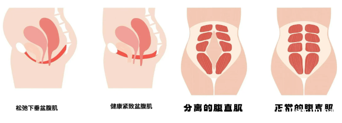 科学产后瘦身:先恢复再减脂 科学产后瘦身:先恢复再减脂