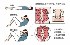 生完娃肚子回不去？不是胖，是“拉链”松了！科学修复看这里