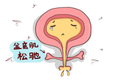 漏尿别硬扛！盆底肌求救，这样修复更高效