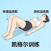 别让盆底肌悄悄“摆烂”！这些习惯超伤肌，科学修复看这篇