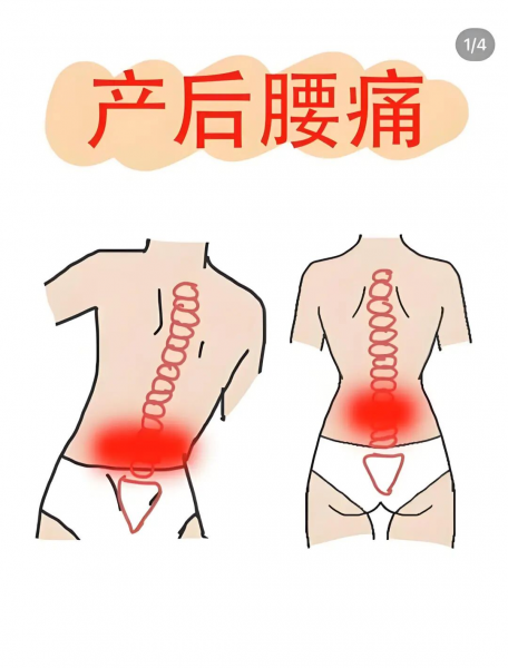 产后身体像在“渡劫”?别硬扛,你的疼痛需要被看见! 产后身体像在“渡劫”?别硬扛,你的疼痛需要被看见!