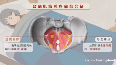 母亲节别只说祝福！妈妈的盆底肌求救，易舒美帮你接住