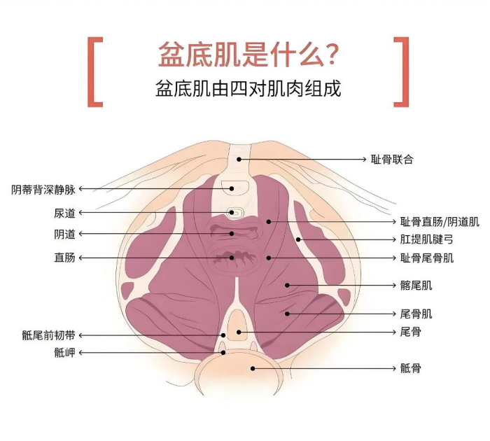 盆底电刺激没痛感就没效果?九成女性都调错强度,易舒美教你正确 盆底电刺激没痛感就没效果?九成女性都调错强度,易舒美教你正确