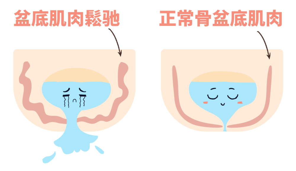男人状态变差,一直被忽略的盆底才是衰老元凶 男人状态变差,一直被忽略的盆底才是衰老元凶
