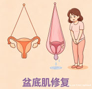 产后别忽视盆底肌修复，守护女性产后健康底气